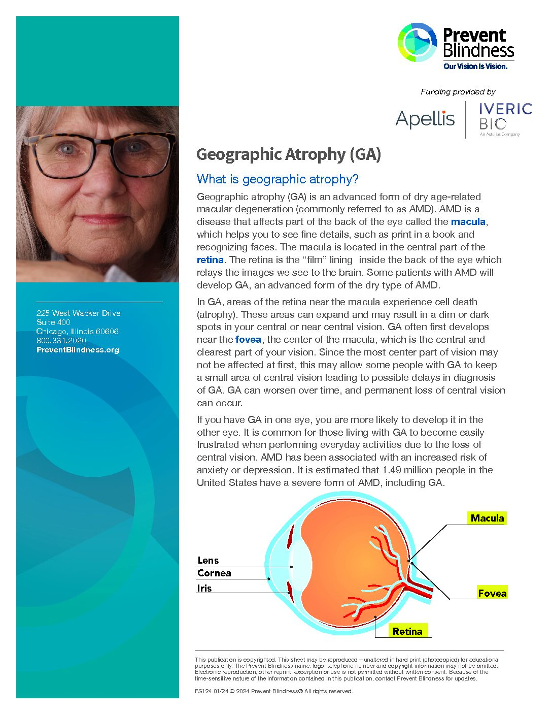 what is ga eye disease