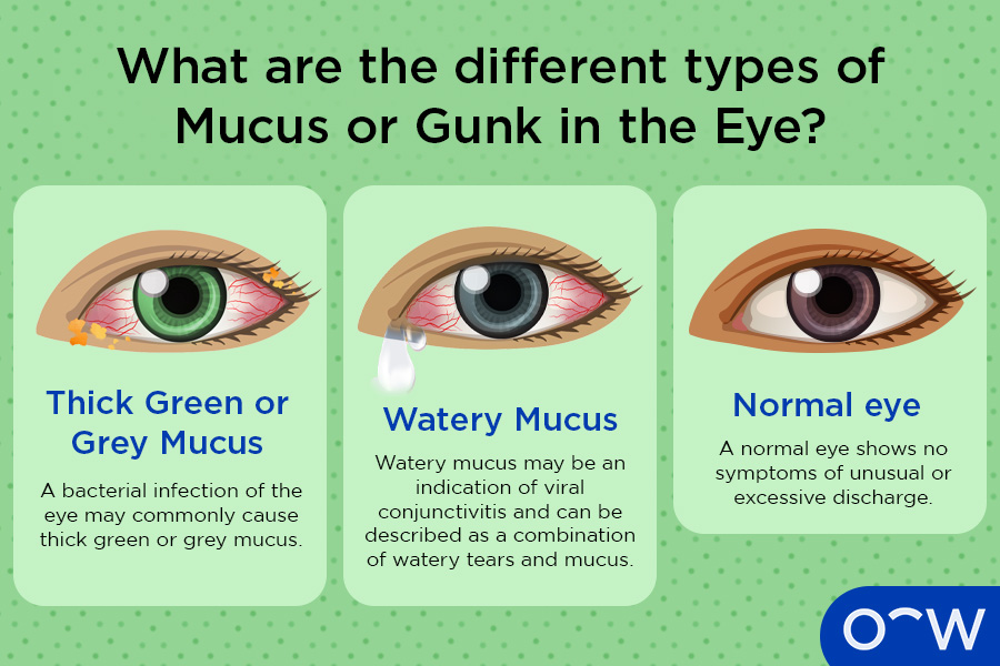 sinus infection eye discharge