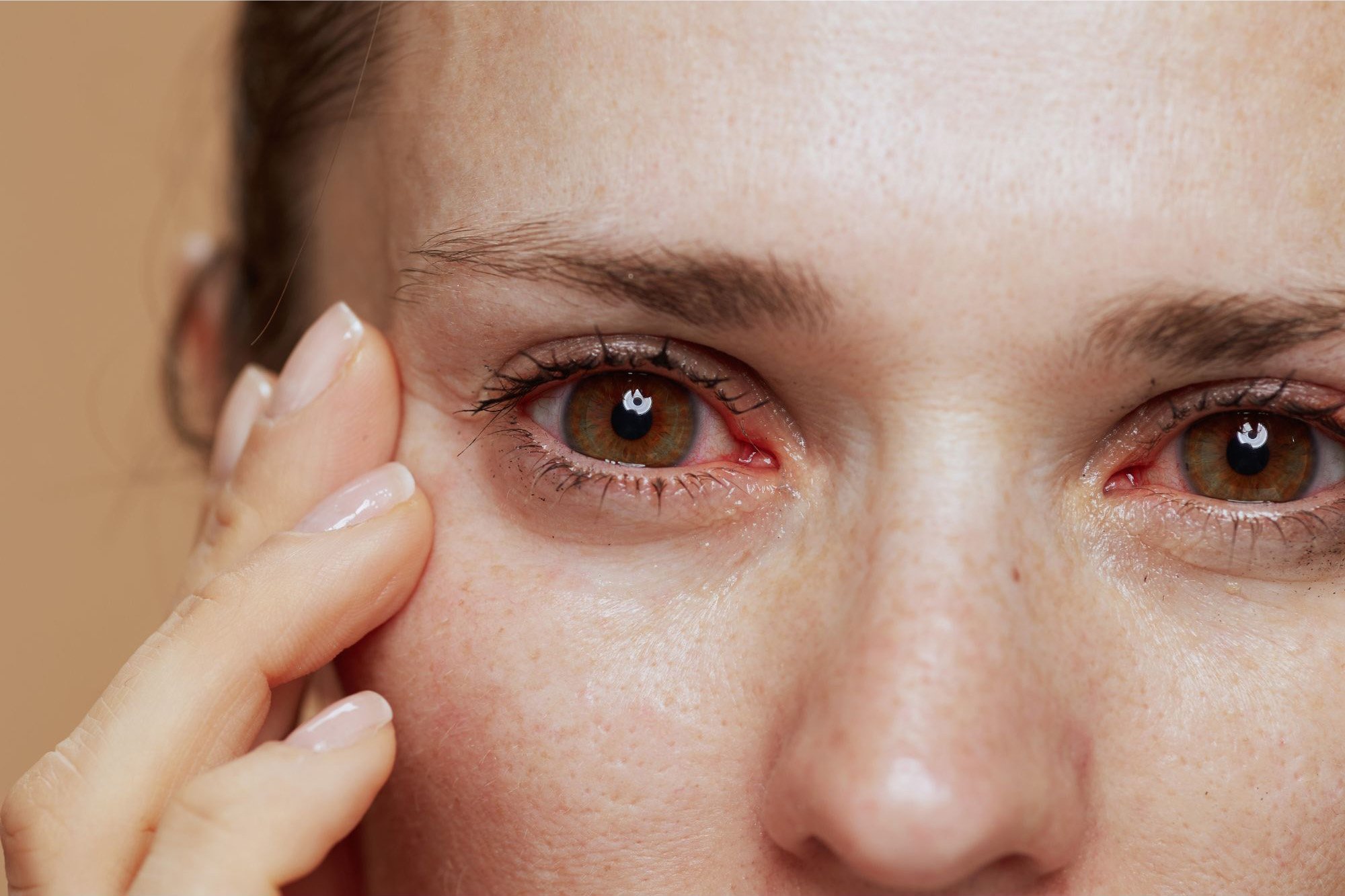 how to cure dry eye